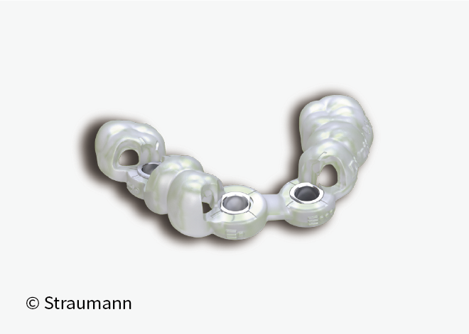 サージカルガイド